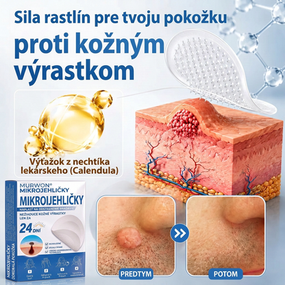 👩‍⚕️💯 Oficiálny obchod | MURWON® 🌥️ Mikroihličková náplasť na odstránenie kožných nedokonalostí (Na kožné výrastky, drobné kožné útvary, bradavice, materské znamienka, starecké škvrny a pigmentové nerovnosti.)💟