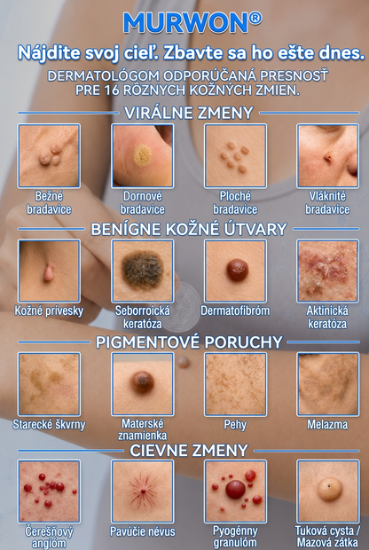 👩‍⚕️💯 Oficiálny obchod | MURWON® 🌥️ Mikroihličková náplasť na odstránenie kožných nedokonalostí (Na kožné výrastky, drobné kožné útvary, bradavice, materské znamienka, starecké škvrny a pigmentové nerovnosti.)💟