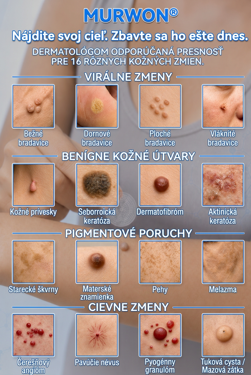 👩‍⚕️💯 Oficiálny obchod | MURWON® 🌥️ Mikroihličková náplasť na odstránenie kožných nedokonalostí (Na kožné výrastky, drobné kožné útvary, bradavice, materské znamienka, starecké škvrny a pigmentové nerovnosti.)💛